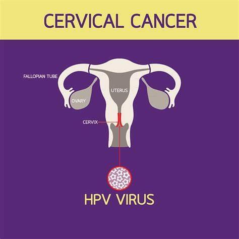 Cervical Cancer